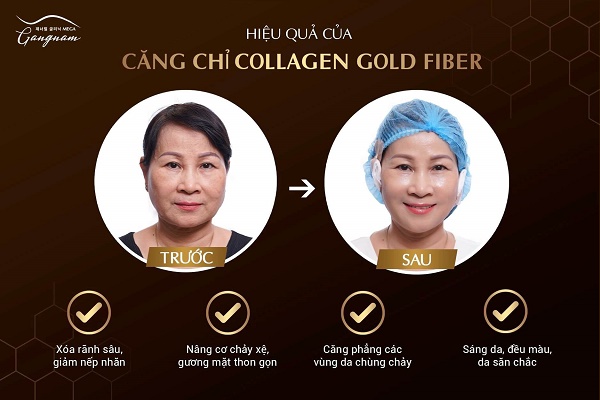 cang chi Collagen Gold Fiber